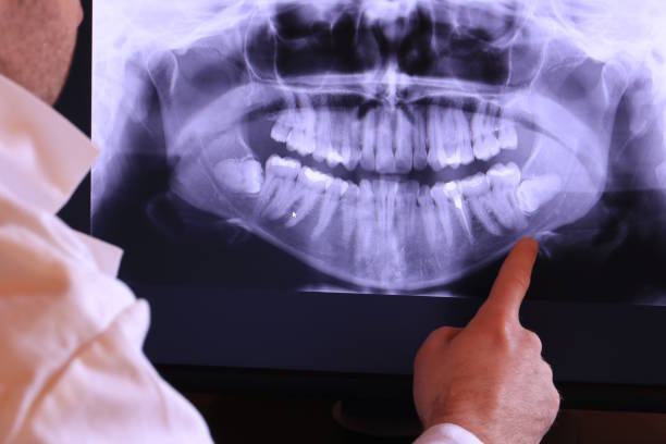 Best Emergency Root Canal Treatment in Vinton, IA