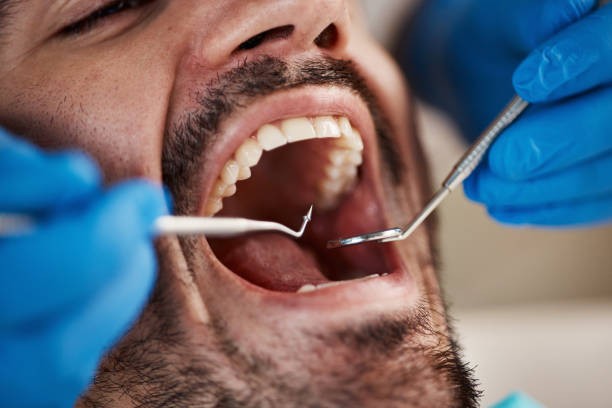Best Pediatric Emergency Dentist in Vinton, IA