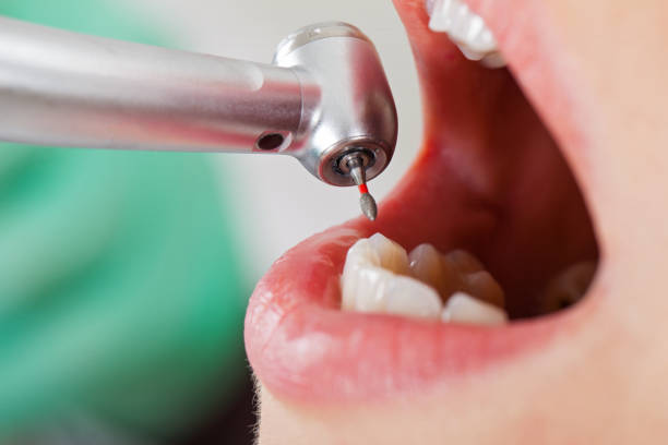 Best Broken or Cracked Tooth Emergency Dentist in Vinton, IA
